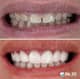 Slider image (10) Dis 212 - Dental Aesthetics Facility